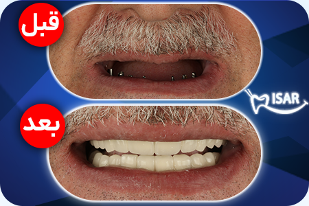 عکس داخل جت جنگی