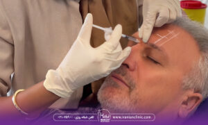 ۵ اشتباه رایج در مورد تزریق بوتاکس که باید بدانید