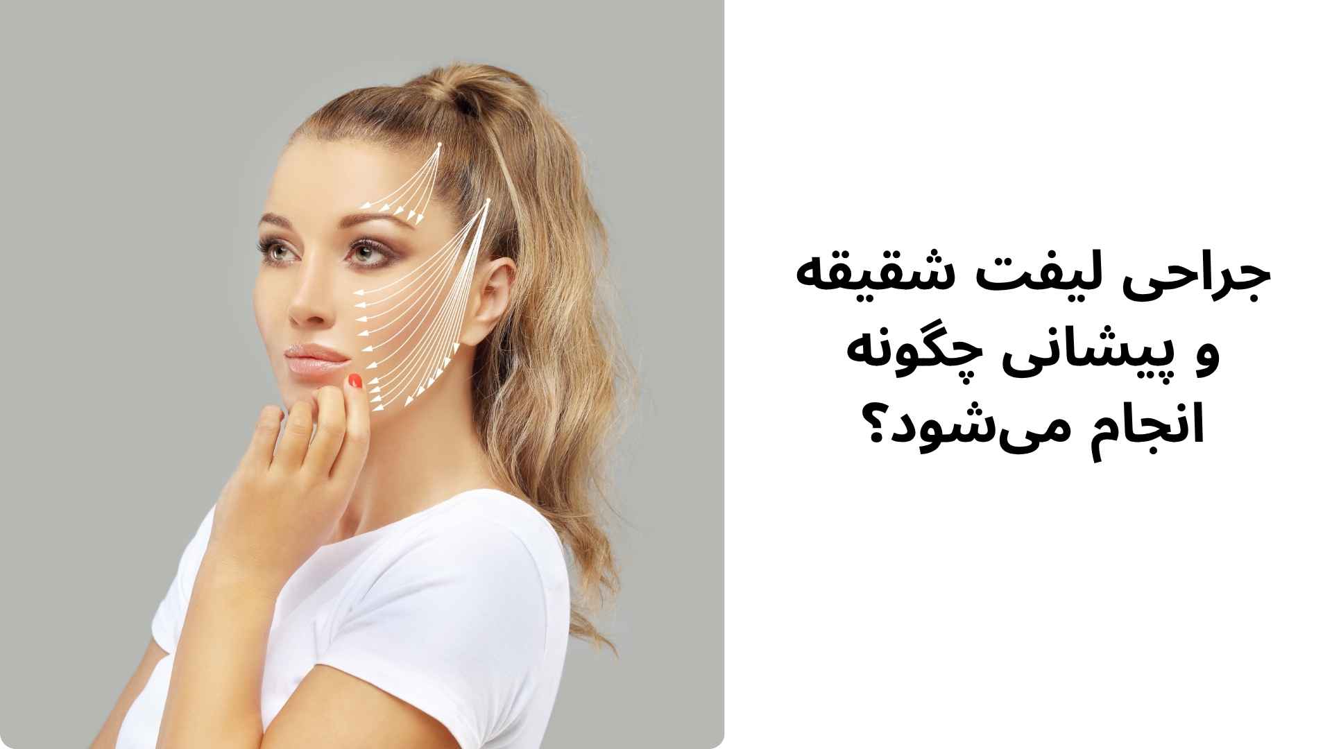 عمل جراحی لیفت شقیقه و پیشانی چیست؟ جراحی لیفت شقیقه و پیشانی چگونه انجام میشود؟