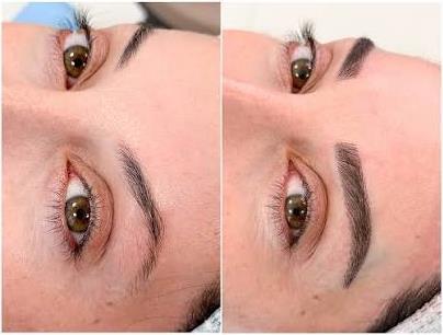کاشت ابرو در مقابل میکروبلیدینگ: مزایا، معایب، مقایسه و تفاوتهای مهم