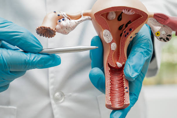 HPV چیست؟ علائم و راه های انتقال و تقویت سیستم ایمنی بدن برای درمان و کنترل بیماری